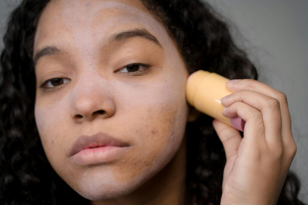 Unveiling the Truth About Dark Spots: A Comprehensive Guide to Even-Toned Skin 1 spots